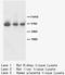 Fibroblast growth factor receptor 2 antibody, LS-C172060, Lifespan Biosciences, Western Blot image 