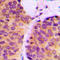 Melan-A antibody, LS-C352206, Lifespan Biosciences, Immunohistochemistry paraffin image 