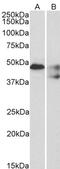 5-Hydroxytryptamine Receptor 1B antibody, PA5-18520, Invitrogen Antibodies, Western Blot image 