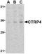 C1q And TNF Related 4 antibody, NBP1-76629, Novus Biologicals, Western Blot image 