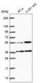 G Kinase Anchoring Protein 1 antibody, HPA066173, Atlas Antibodies, Western Blot image 
