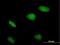Zinc finger and BTB domain-containing protein 32 antibody, H00027033-B01P, Novus Biologicals, Immunocytochemistry image 