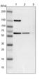 UPF3B Regulator Of Nonsense Mediated MRNA Decay antibody, PA5-51638, Invitrogen Antibodies, Western Blot image 