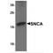 Synuclein Alpha antibody, TA349077, Origene, Western Blot image 