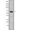 DNA Cross-Link Repair 1B antibody, abx149747, Abbexa, Western Blot image 