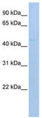 Protein mab-21-like 1 antibody, TA335099, Origene, Western Blot image 