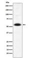 DNA Methyltransferase 1 Associated Protein 1 antibody, M03688, Boster Biological Technology, Western Blot image 