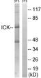 Serine/threonine-protein kinase ICK antibody, LS-C199091, Lifespan Biosciences, Western Blot image 