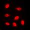 Autoimmunogenic cancer/testis antigen NY-ESO-2 antibody, orb101530, Biorbyt, Immunofluorescence image 