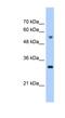 Tetratricopeptide Repeat Domain 5 antibody, NBP1-53012, Novus Biologicals, Western Blot image 