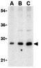 B Cell Receptor Associated Protein 29 antibody, GTX85073, GeneTex, Western Blot image 