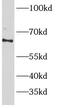 5 -AMP-activated protein kinase subunit gamma-2 antibody, FNab00380, FineTest, Western Blot image 