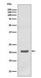Mitochondrially Encoded Cytochrome C Oxidase II antibody, M03631, Boster Biological Technology, Western Blot image 