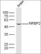 Core histone macro-H2A.1 antibody, orb341227, Biorbyt, Western Blot image 
