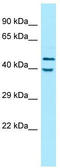 Killer Cell Immunoglobulin Like Receptor, Two Ig Domains And Long Cytoplasmic Tail 5A antibody, TA338022, Origene, Western Blot image 