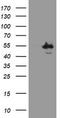 Chimerin 1 antibody, CF505110, Origene, Western Blot image 
