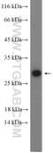 Adiponectin, C1Q And Collagen Domain Containing antibody, 21613-1-AP, Proteintech Group, Western Blot image 