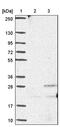 Ankyrin Repeat Domain 39 antibody, PA5-60077, Invitrogen Antibodies, Western Blot image 