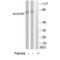 Solute Carrier Organic Anion Transporter Family Member 1B1 antibody, A01375, Boster Biological Technology, Western Blot image 