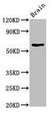 Beta-hexosaminidase subunit alpha antibody, CSB-PA12259A0Rb, Cusabio, Western Blot image 