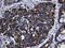 Mitochondrial Ribosomal Protein L48 antibody, M15184-1, Boster Biological Technology, Immunohistochemistry paraffin image 