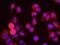 Structural Maintenance Of Chromosomes 1A antibody, GTX21276, GeneTex, Proximity Ligation Assay image 