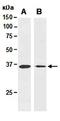 Calponin 3 antibody, orb66948, Biorbyt, Western Blot image 