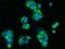 Serine Peptidase Inhibitor, Kunitz Type 2 antibody, GTX02393, GeneTex, Immunofluorescence image 
