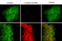 Junction Plakoglobin antibody, CM1111, ECM Biosciences, Immunocytochemistry image 