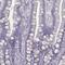 Zinc Finger Protein 365 antibody, PA5-62611, Invitrogen Antibodies, Immunohistochemistry paraffin image 