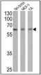 Retinoic Acid Receptor Alpha antibody, MA1-810A, Invitrogen Antibodies, Western Blot image 