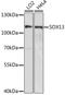 SRY-Box 13 antibody, A15759, ABclonal Technology, Western Blot image 