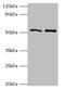 Golgi-associated PDZ and coiled-coil motif-containing protein antibody, orb353220, Biorbyt, Western Blot image 