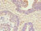 ANTXR Cell Adhesion Molecule 2 antibody, OACA08144, Aviva Systems Biology, Immunohistochemistry frozen image 