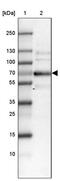 Sorbin And SH3 Domain Containing 1 antibody, PA5-55656, Invitrogen Antibodies, Western Blot image 