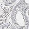 Myoferlin antibody, HPA014245, Atlas Antibodies, Immunohistochemistry frozen image 