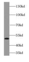 Forkhead Box L2 antibody, FNab03199, FineTest, Western Blot image 