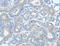 Argonaute RISC Catalytic Component 2 antibody, LS-C401199, Lifespan Biosciences, Immunohistochemistry paraffin image 