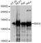 Structural Maintenance Of Chromosomes 4 antibody, A13933, ABclonal Technology, Western Blot image 