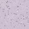 Zinc Finger Protein 853 antibody, HPA067690, Atlas Antibodies, Immunohistochemistry paraffin image 