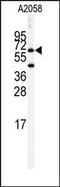 Butyrylcholinesterase antibody, AP14658PU-N, Origene, Western Blot image 