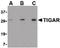TP53 Induced Glycolysis Regulatory Phosphatase antibody, LS-B462, Lifespan Biosciences, Western Blot image 