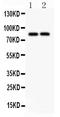 Solute Carrier Family 15 Member 2 antibody, PB9393, Boster Biological Technology, Western Blot image 