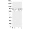 DNA replication licensing factor MCM6 antibody, R30862, NSJ Bioreagents, Western Blot image 