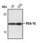 Proliferation And Apoptosis Adaptor Protein 15 antibody, PA5-17326, Invitrogen Antibodies, Western Blot image 