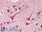 Cell Death Inducing DFFA Like Effector B antibody, LS-B482, Lifespan Biosciences, Immunohistochemistry paraffin image 