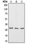Aquaporin 12A antibody, MBS820721, MyBioSource, Western Blot image 