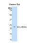 Lecithin-Cholesterol Acyltransferase antibody, LS-C298062, Lifespan Biosciences, Western Blot image 