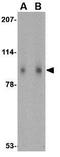 SLIT and NTRK-like protein 1 antibody, GTX31333, GeneTex, Western Blot image 