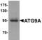 Autophagy Related 9A antibody, AHP2248, Bio-Rad (formerly AbD Serotec) , Immunohistochemistry paraffin image 